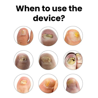 Nail Polishing Care Instrument